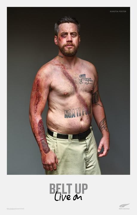 Esta campaña de seguridad vial muestra las marcas que dejan los accidentes en las víctimas