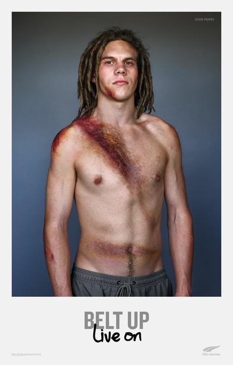 Esta campaña de seguridad vial muestra las marcas que dejan los accidentes en las víctimas