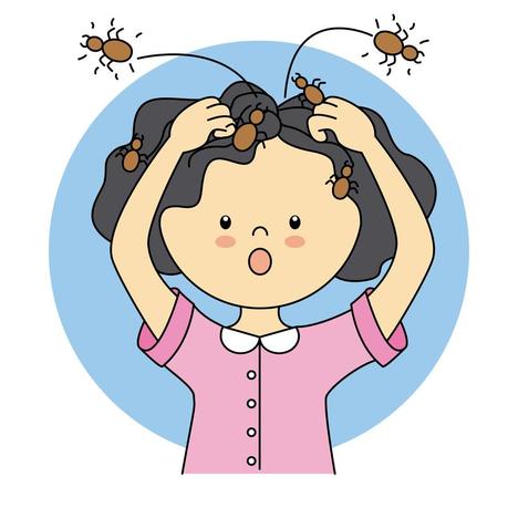 El ciclo vital de los piojos en los niños El ciclo vital de los piojos en los niños