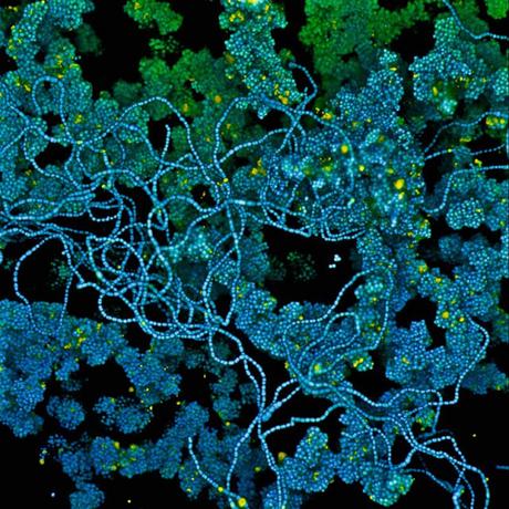 microorganismos en microscopio microorganismos en microscopio