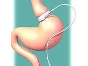 Tratamiento Quirurgico Diabetes tipo