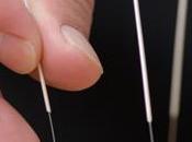 acupuntura podría ayudar aliviar sofocos relacionados tratamiento cáncer próstata