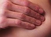 estudio vincula cáncer mama excesivo anticonceptivos