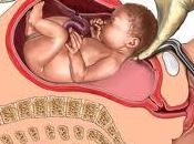 ¿Cómo practica cesárea?