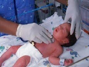 Apnea de la prematuridad