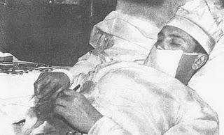 Apendicitis: operar, no operar...o autooperarse