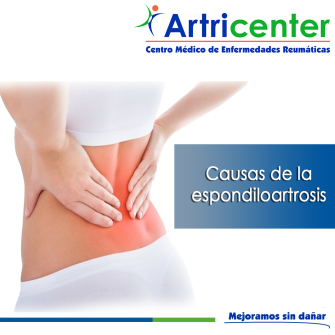 Artricenter: Síntomas principales de la espondiloartrosis