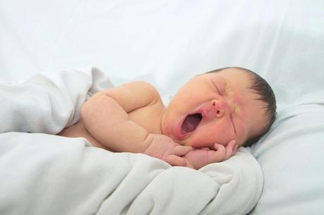 La ictericia del recién nacido