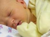 ictericia recién nacido