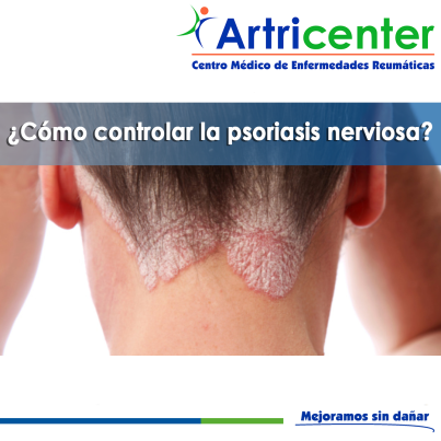 Artricenter: ¿Cómo controlar la psoriasis nerviosa? Artricenter: ¿Cómo controlar la psoriasis nerviosa?