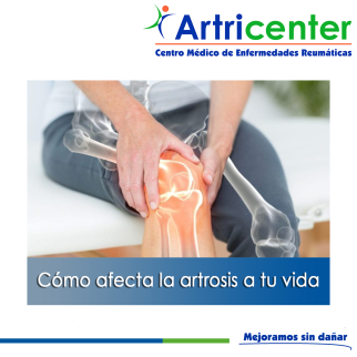Artricenter: Cómo afecta la artrosis a tu vida