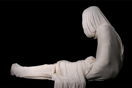 El extraño síndrome de Lázaro El extraño síndrome de Lázaro