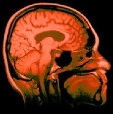 Mentes libres y cadenas mentales