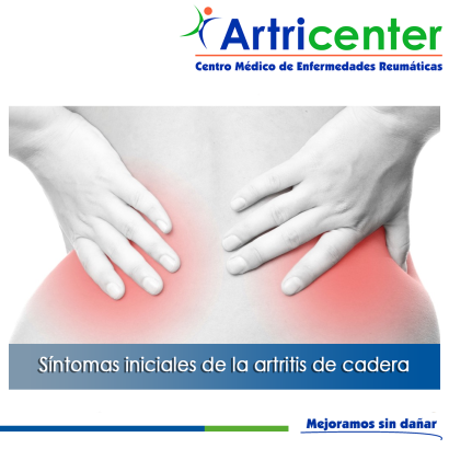 Artricenter: Síntomas iniciales de la osteoartritis de cadera.