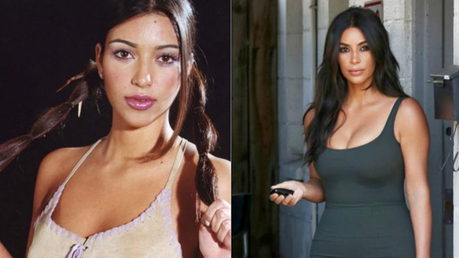 Las operaciones de #KimKardashian que la hacen lucir una espectacular figura #Belleza #Mujeres #Botox #Estetica #Kardashian (FOTOS)