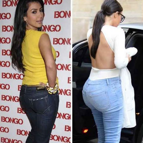 Las operaciones de #KimKardashian que la hacen lucir una espectacular figura #Belleza #Mujeres #Botox #Estetica #Kardashian (FOTOS)