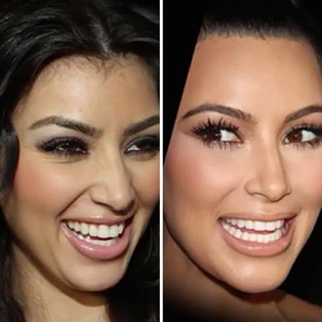 Las operaciones de #KimKardashian que la hacen lucir una espectacular figura #Belleza #Mujeres #Botox #Estetica #Kardashian (FOTOS)