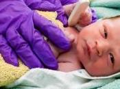 Test APGAR: puntuación recién nacido