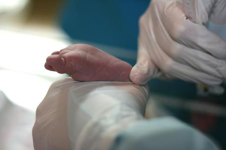 Test de APGAR: puntuación del recién nacido