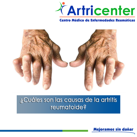 Artricenter: Diferencias entre artritis y artrosis