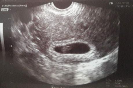 ¡Estoy embarazada! Así ha sido mi primer trimestre ¡Estoy embarazada! Así ha sido mi primer trimestre
