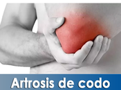 Artricenter: Artrosis codo