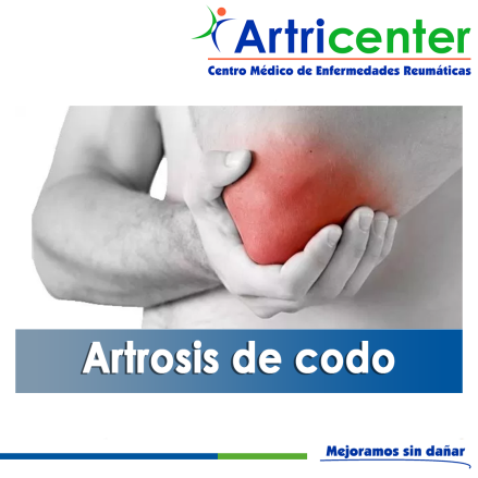 Artricenter: Artrosis de codo