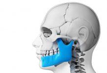 ¿Está mi mandíbula rota o dislocada? mandíbula rota o dislocada