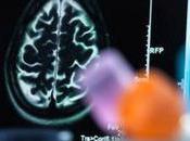 ¿Qué efectivos antidepresivos cómo seleccionar adecuado para usted?