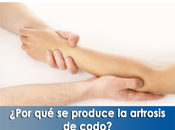 Artricenter: ¿Por produce artrosis codo?