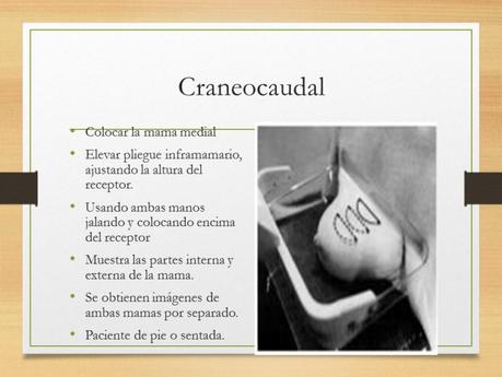 PROYECCIONES MASTOGRAFICAS