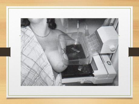 PROYECCIONES MASTOGRAFICAS