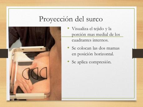 PROYECCIONES MASTOGRAFICAS