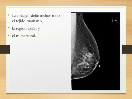PROYECCIONES MASTOGRAFICAS