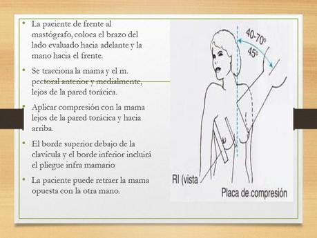 PROYECCIONES MASTOGRAFICAS