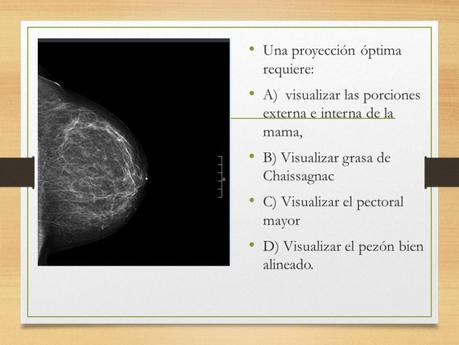 PROYECCIONES MASTOGRAFICAS