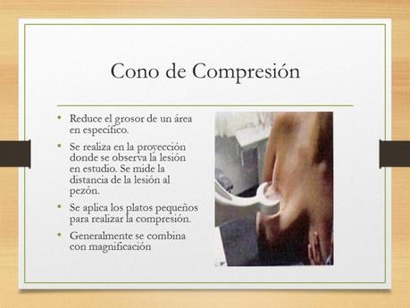 PROYECCIONES MASTOGRAFICAS