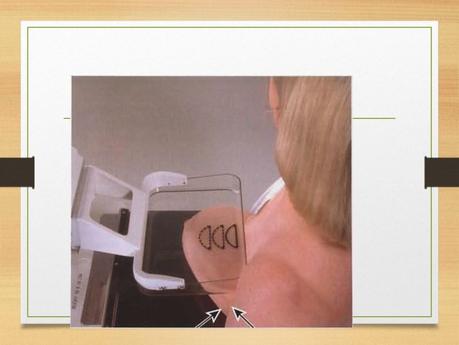 PROYECCIONES MASTOGRAFICAS