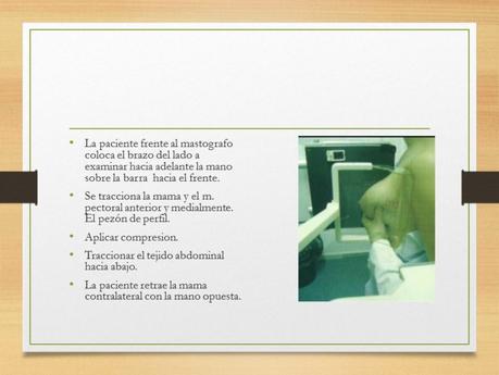 PROYECCIONES MASTOGRAFICAS