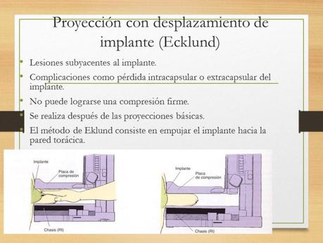 PROYECCIONES MASTOGRAFICAS