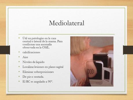 PROYECCIONES MASTOGRAFICAS