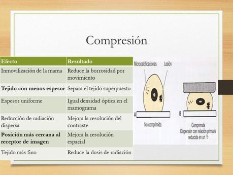 PROYECCIONES MASTOGRAFICAS