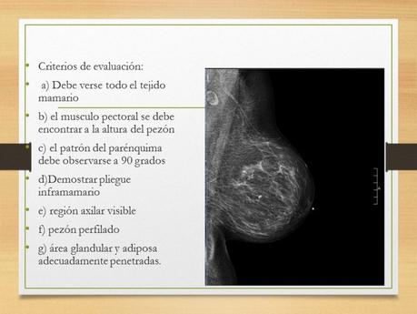 PROYECCIONES MASTOGRAFICAS