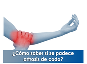 Artricenter: ¿Cómo saber padece artrosis codo?
