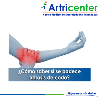 Artricenter: ¿Cómo saber si se padece artrosis de codo?