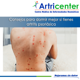 Artricenter: Consejos para dormir mejor si tienes artritis psoriásica