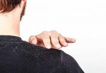 10 Remedios naturales para la caspa