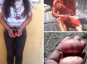 Esposa cansada infidelidades marido, emborracha corta testículos