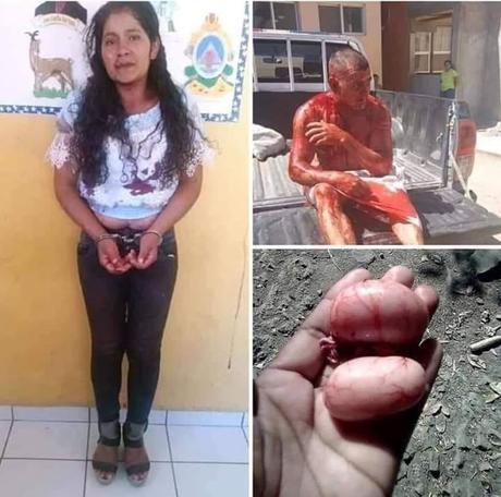 Esposa cansada de las infidelidades de su marido, lo emborracha y le corta los testículos