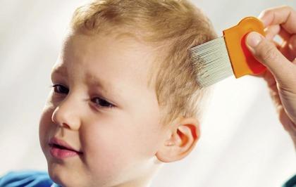 Todo lo que debes saber sobre los piojos